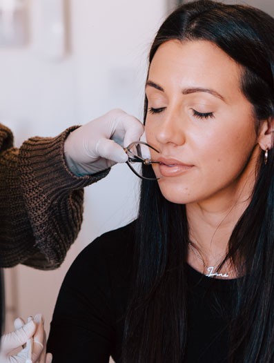 Lip fillers Newcastle
