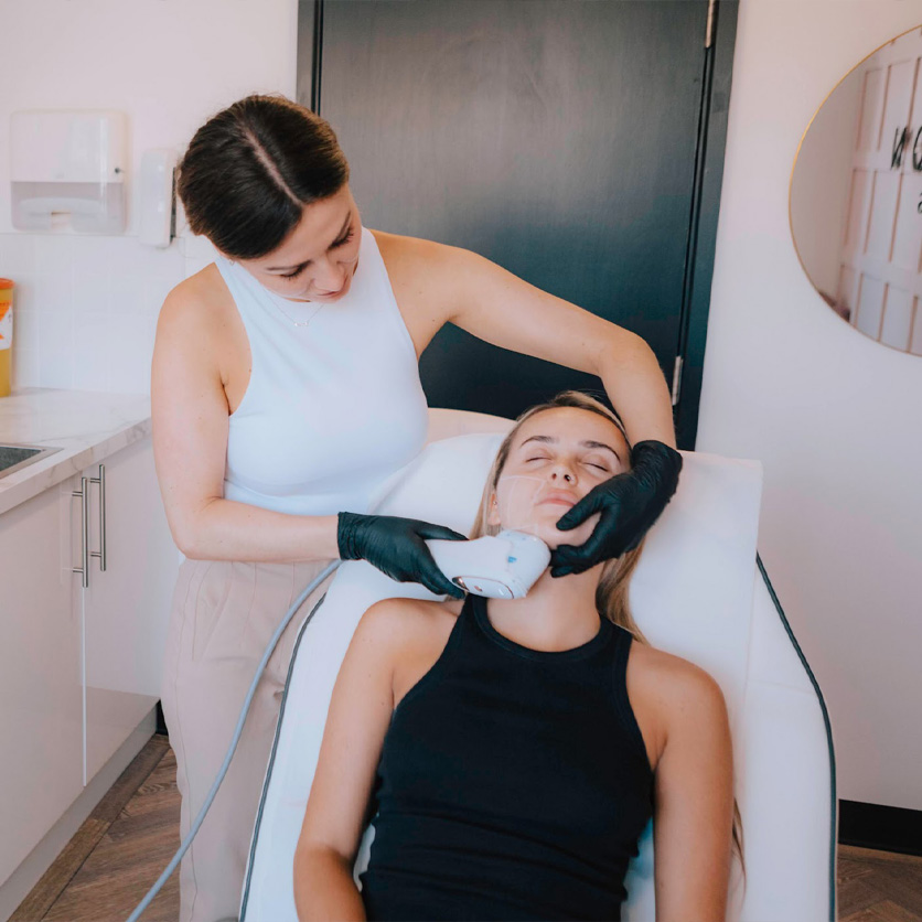 RF micro needling Newcastle