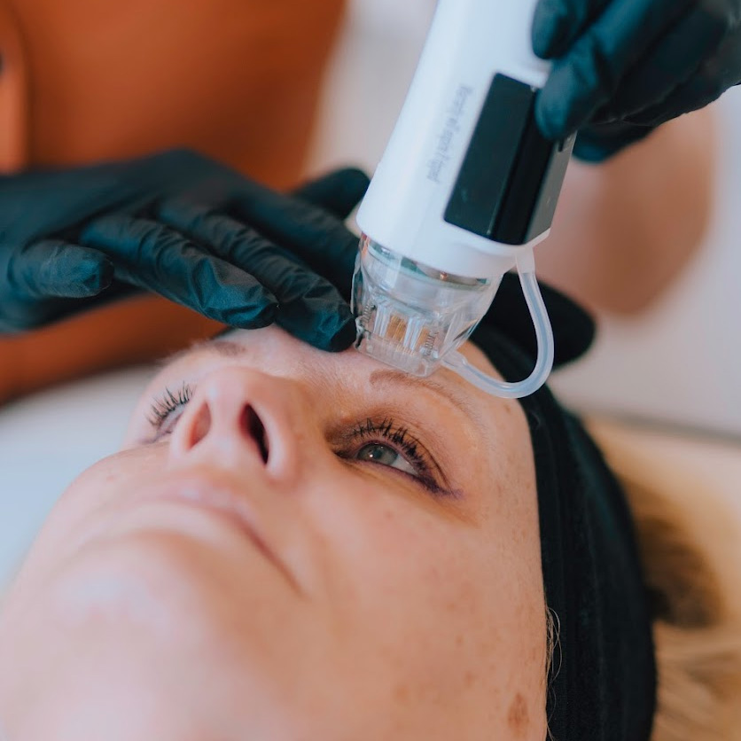 Best Anti wrinkle clinic Newcastle