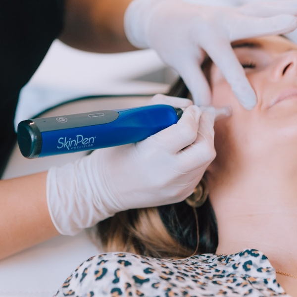 SkinPen